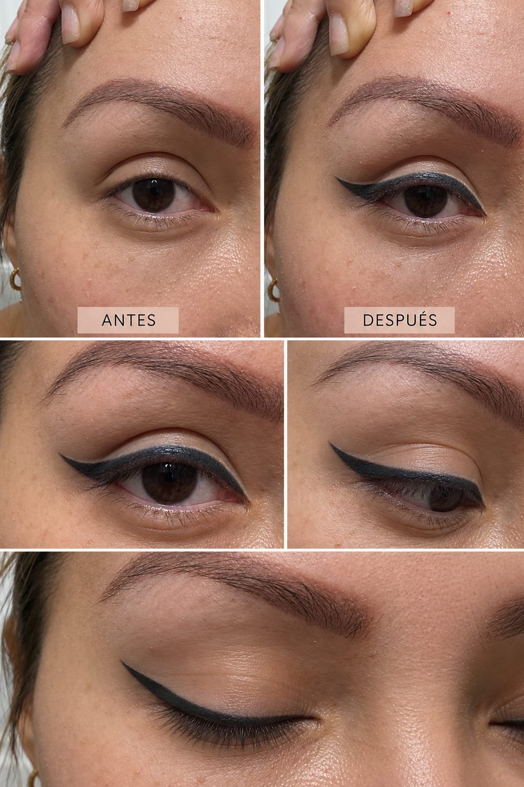 Gisel Micro Beautis