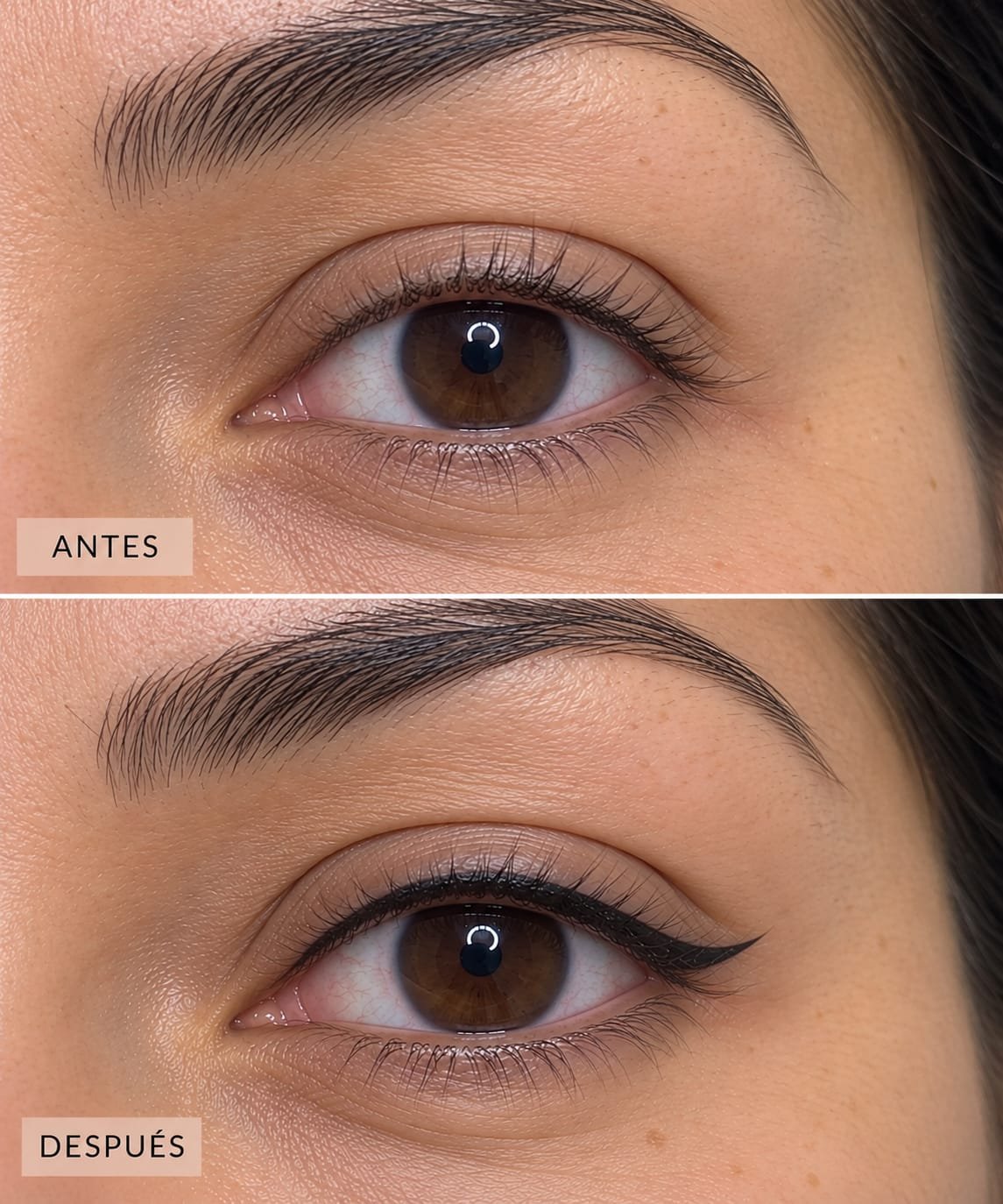 Gisel Micro Beautis